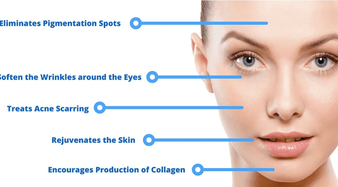 REJUVAPEN NXT MICRONEEDLING IN GULFPORT, MS